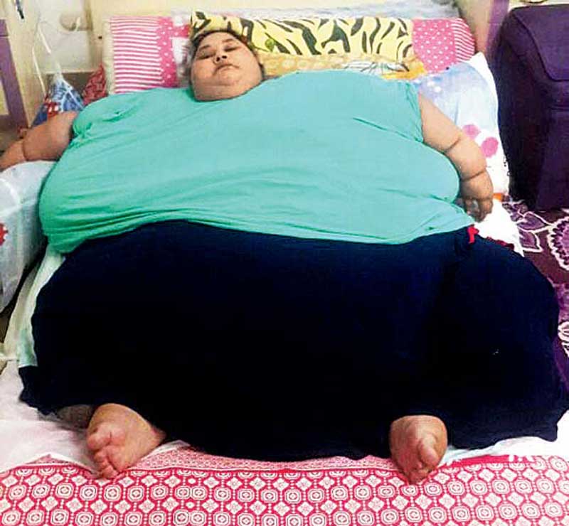 Worlds Heaviest Woman Eman Ahmed Loses Over 100 Kg In 3 Weeks Through 