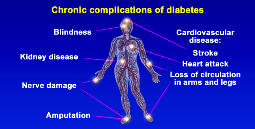 chronic complications of diabetes