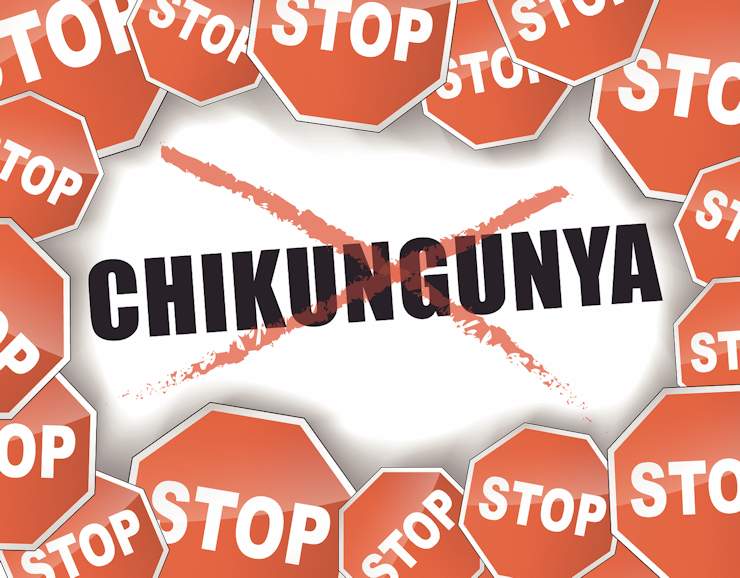 6 Best Home Remedies To Treat Chikungunya