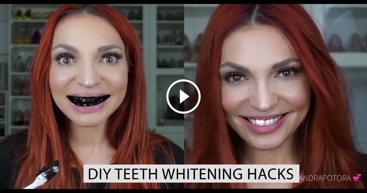 Diy Teeth Whitening Hacks