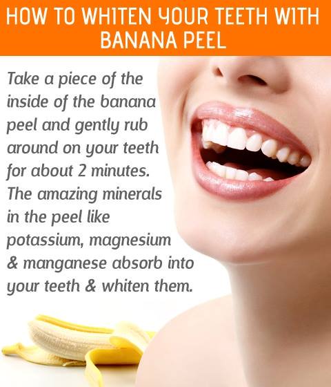 diy teeth whitening hacks