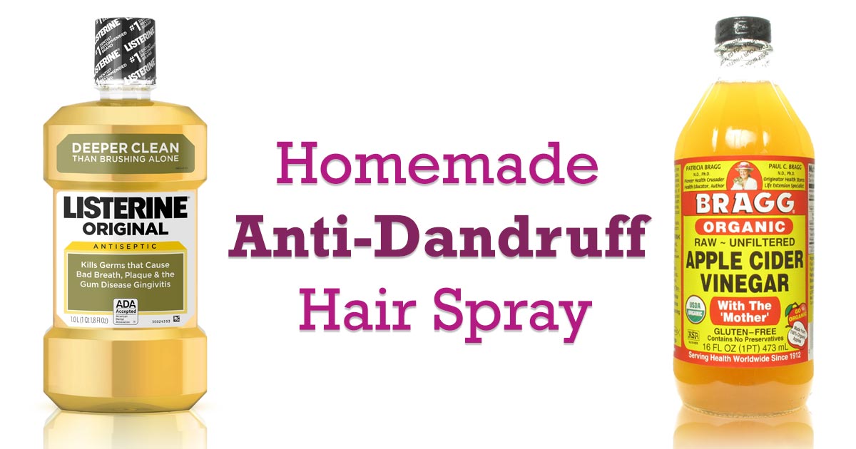 Homemade Anti Dandruff Spray