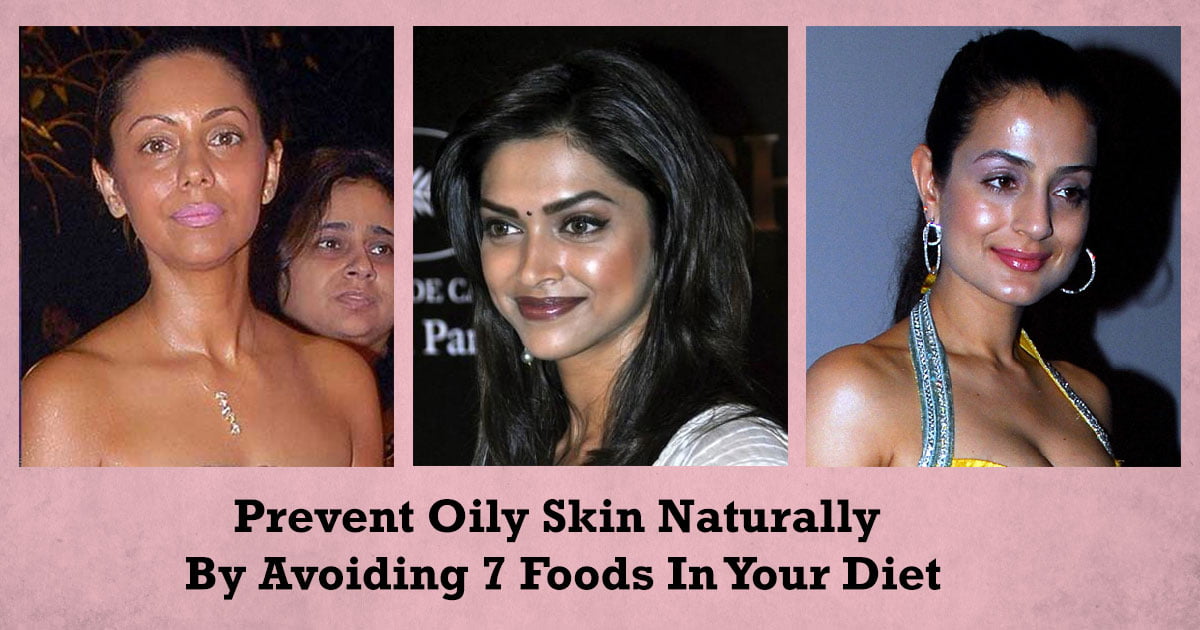 Prevent Oily Skin Naturally