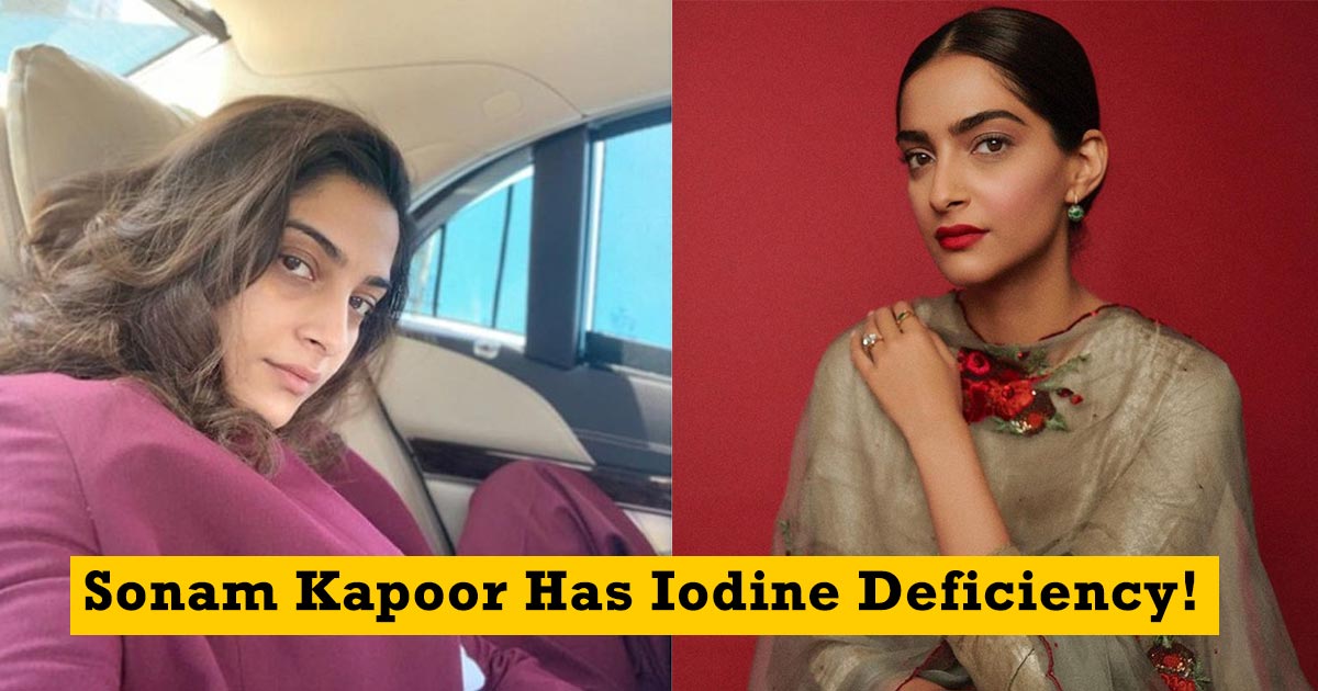 Sonam Kapoor Has Iodine Deficiency!